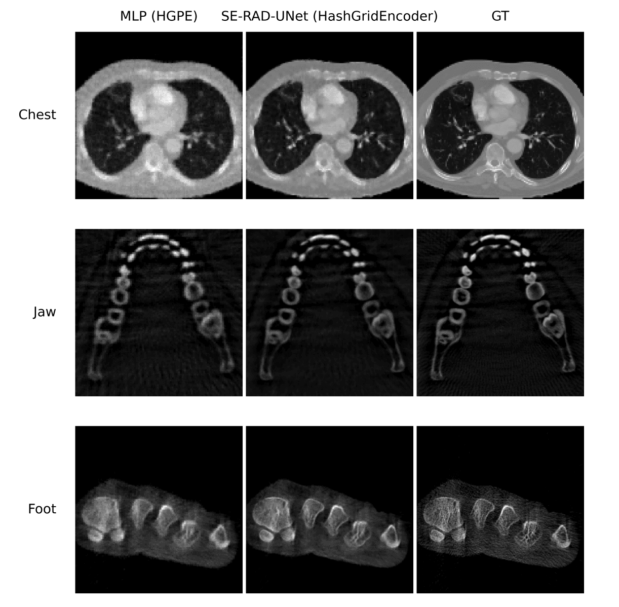 CBCT reconstruction comparison between the MLP baseline, SE-RAD-UNet and ground truth